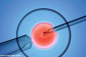 代生男孩价格生殖中心